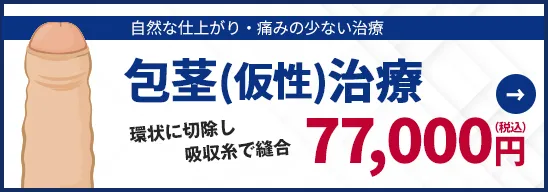 包茎(仮性)治療 環状に切除し吸収糸で縫合 77,000円（税込）