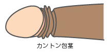カントン包茎（全国）