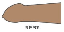 真性包茎（全国）