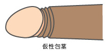 仮性包茎（全国）