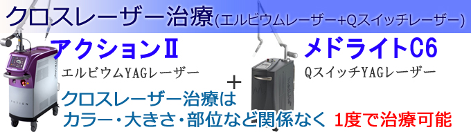 石川県では当院のみの最新タトゥー治療法lp