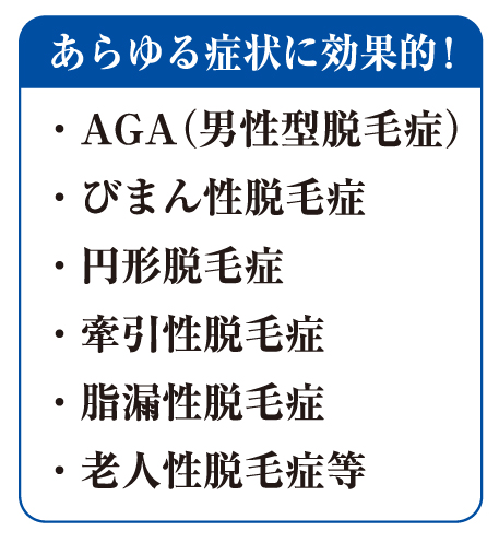 あらゆる脱毛症に効果的